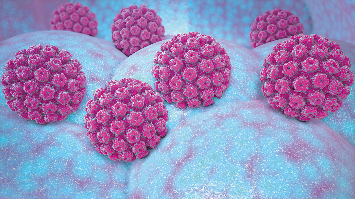 HPV Testing Guidelines Updated for Head and Neck Carcinomas