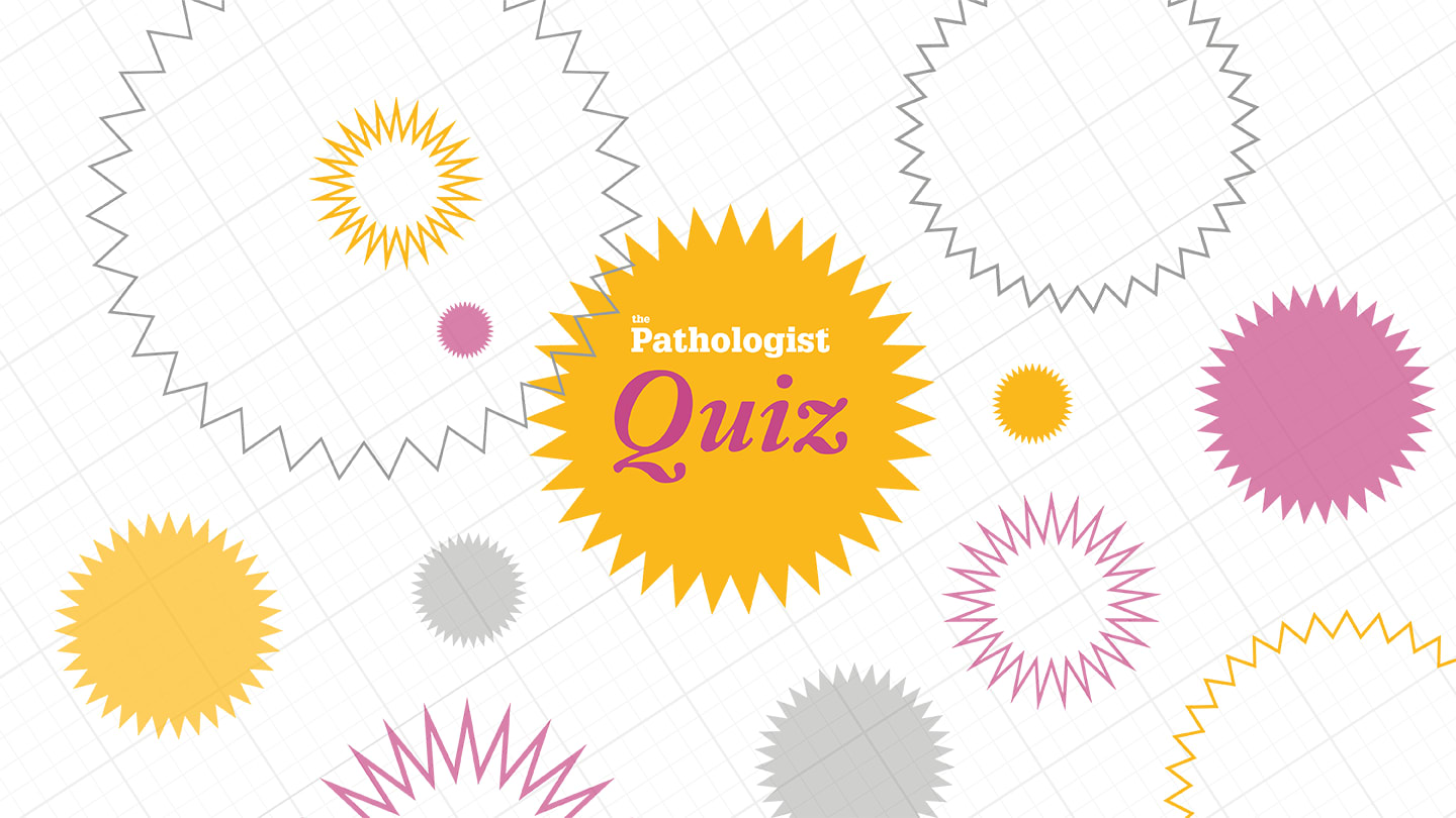 Quiz Time! June 2025
