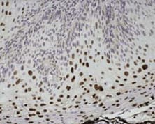 Unique Nanopolymer IHC Detection Reagents