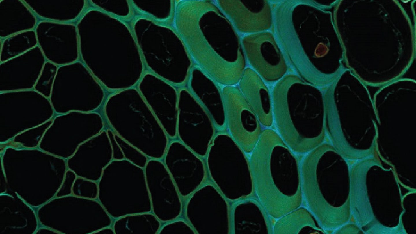 New Microscopy Method Tackles Thick Tissues
