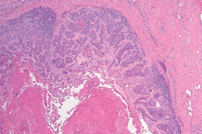 Case of the Month (2)