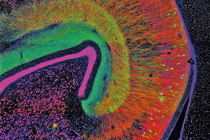 The Color in the Cranium