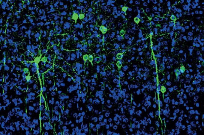 The Cortex-Characterizing Consortium