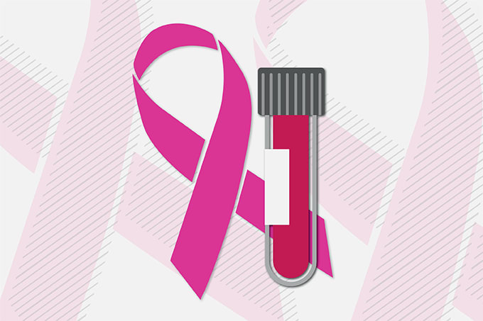 Breast Cancer Protein Patrol