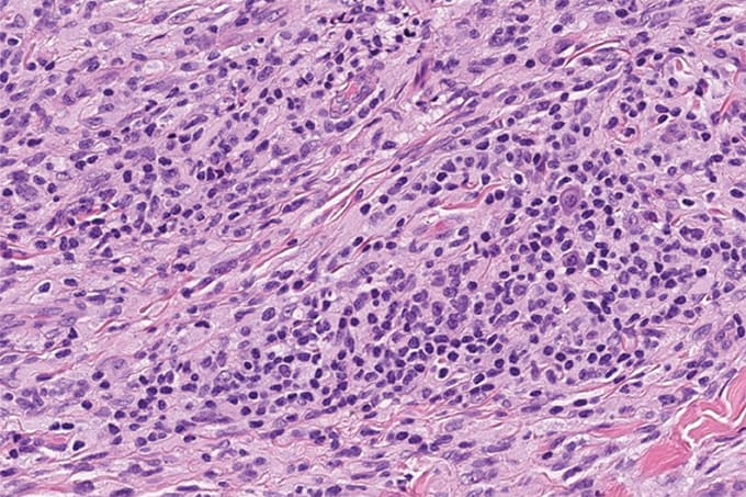 Case of the Month (2)