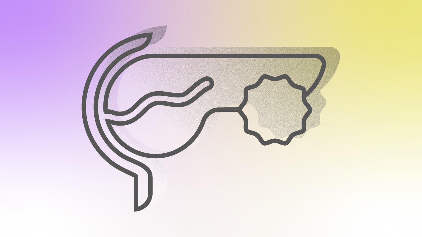 A New Diagnostic Target in Insulinoma