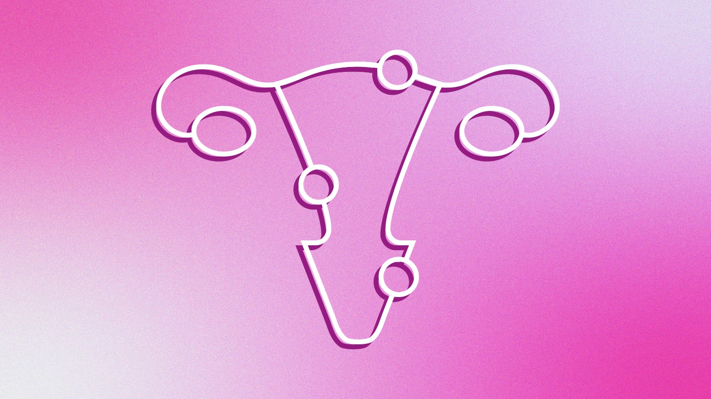 Could Genomics Improve Endometriosis Diagnosis?