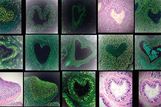 A Tissue Slide after My Own Heart