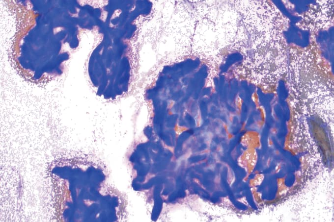 Case of the Month (4)