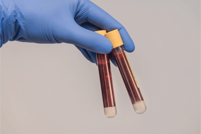 Finding Viruses Hidden in Plain Sight