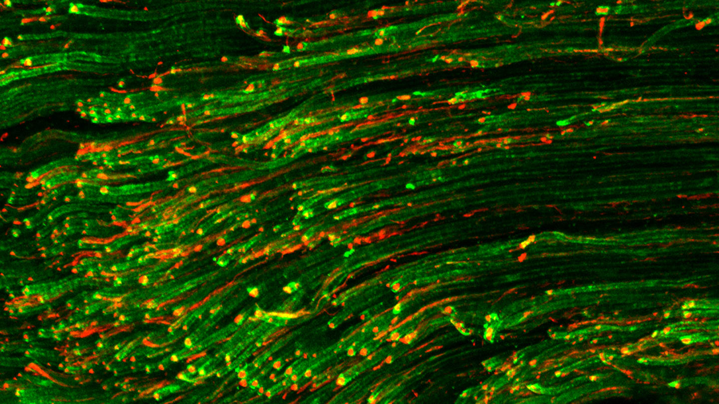 Spectroscopy Roundup: Myelin, Metal Rings and Viral Vectors 