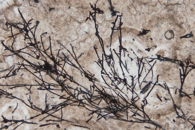 Image of the Month: Old Mold