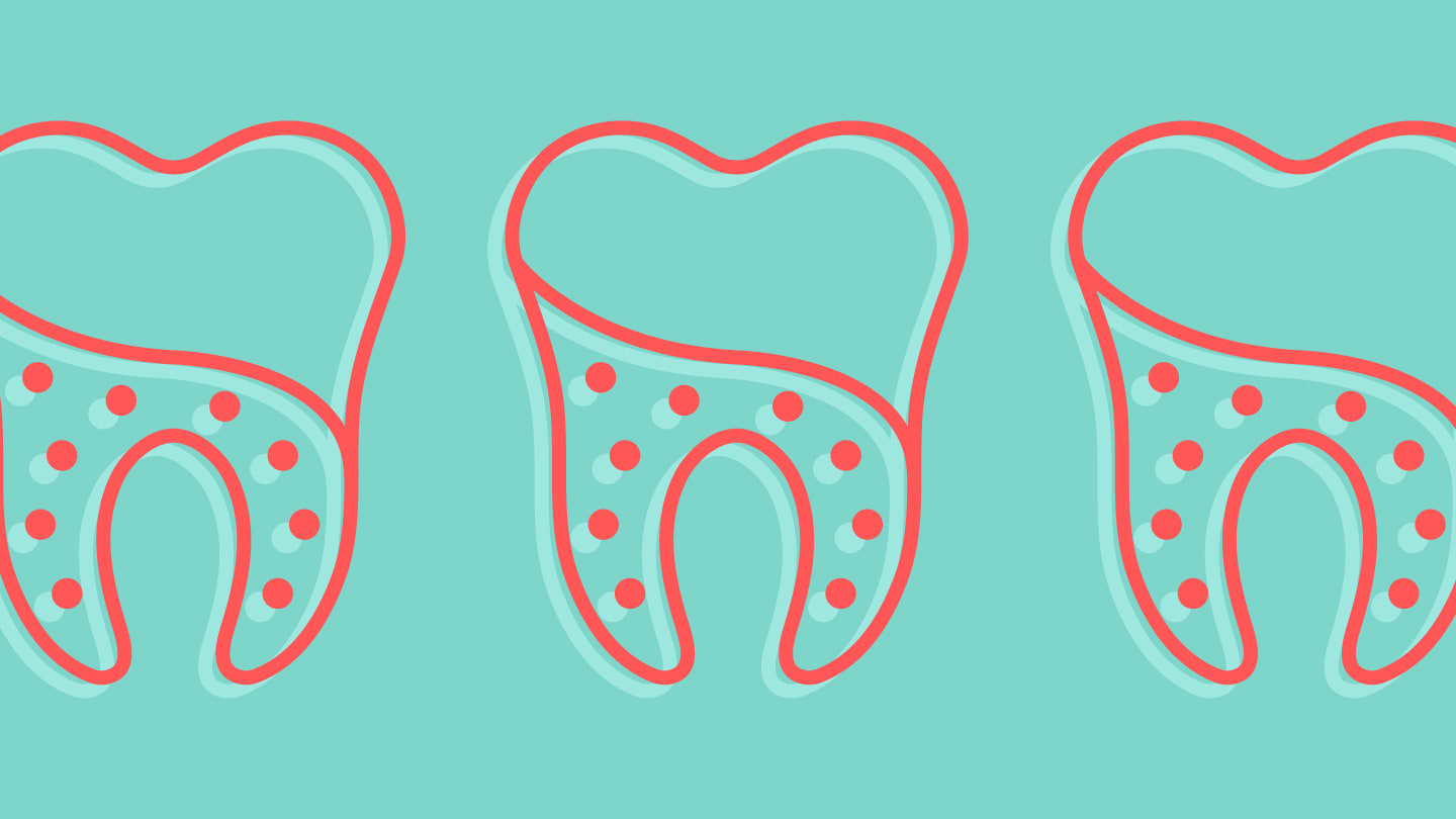 A Microbial Time Capsule in Dental Plaque