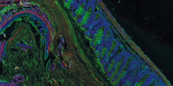 Inside Intestinal Disease