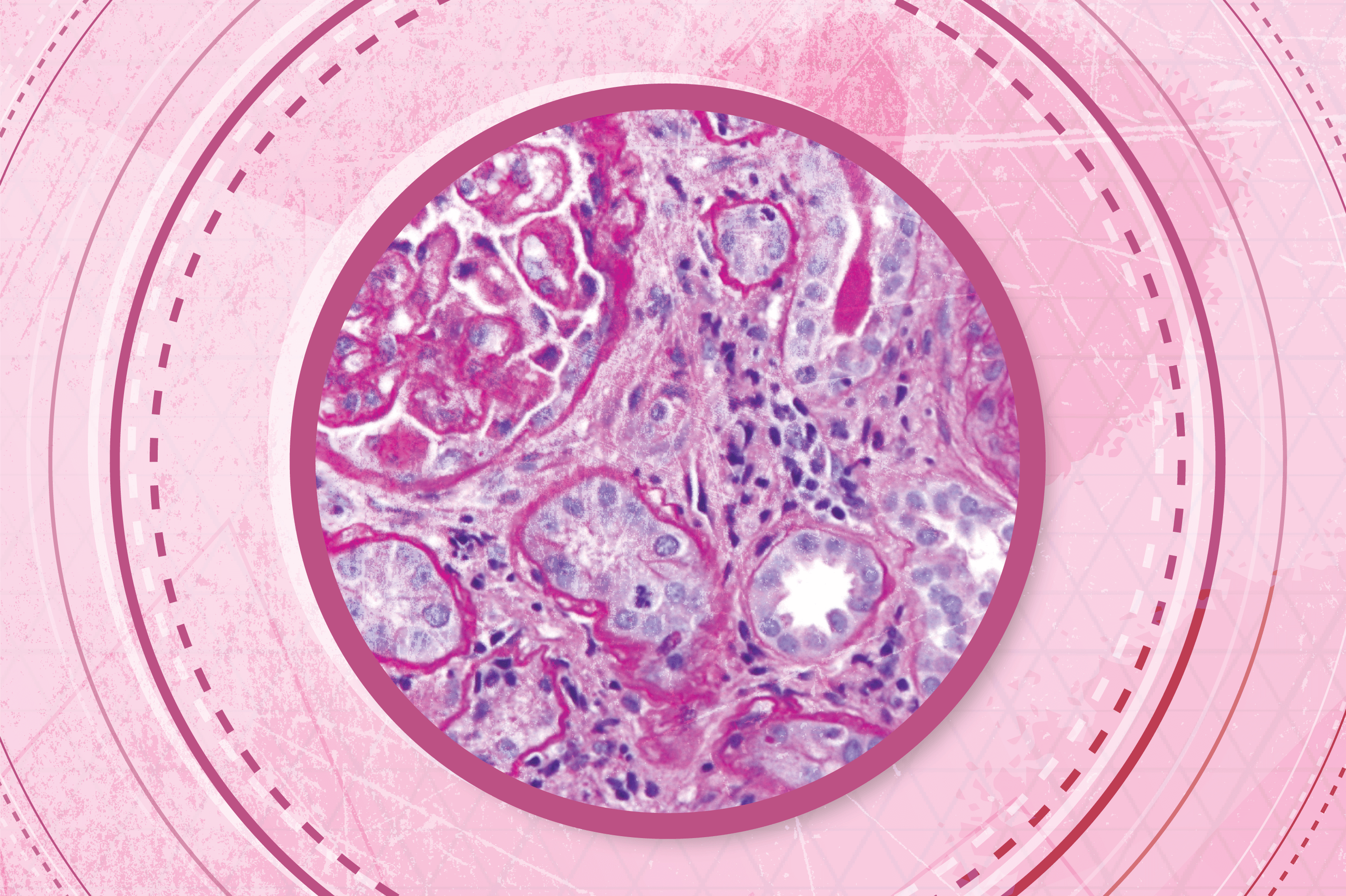 Averting a Histopathology Crisis