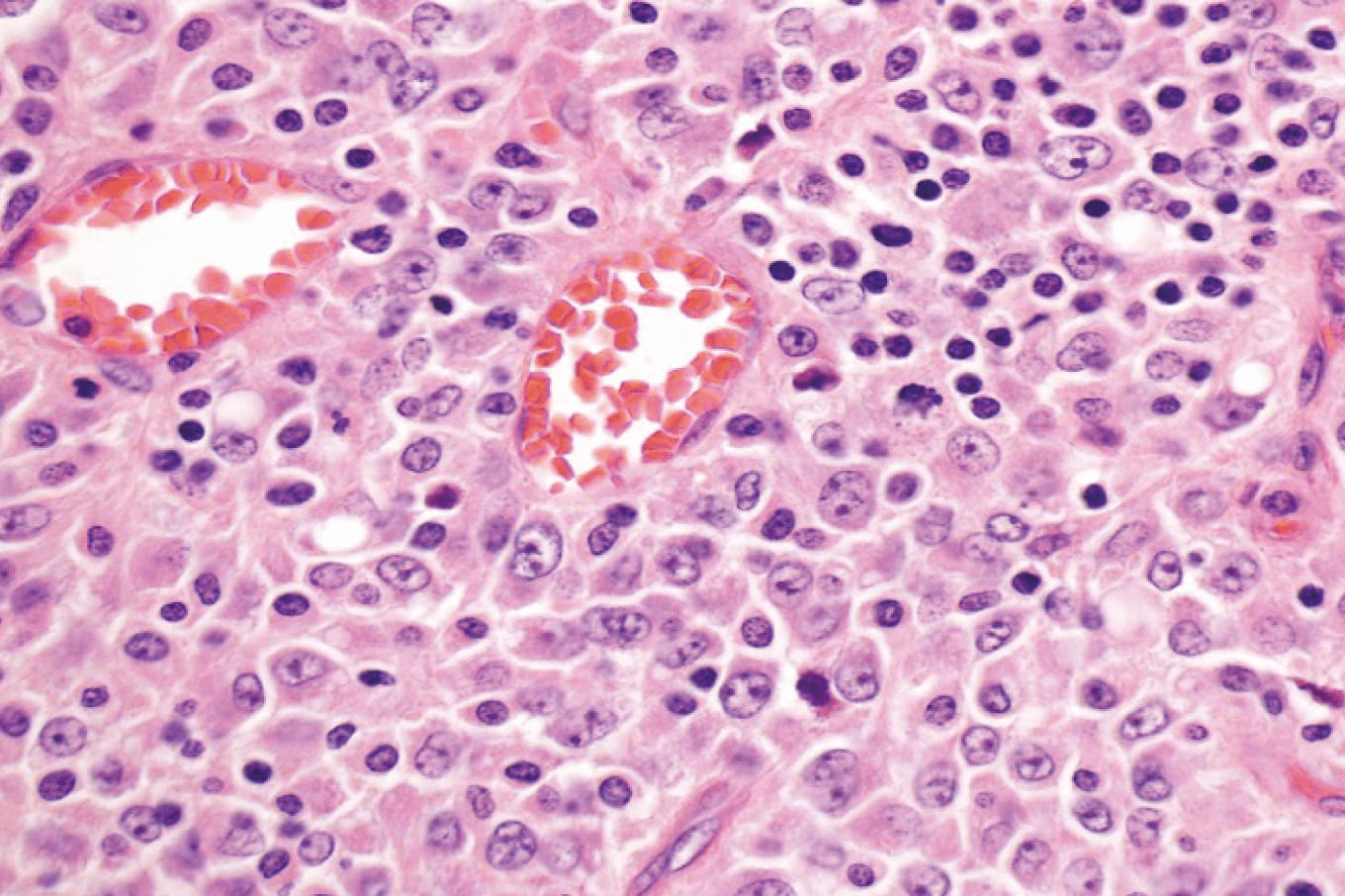 Case of the Month (1)