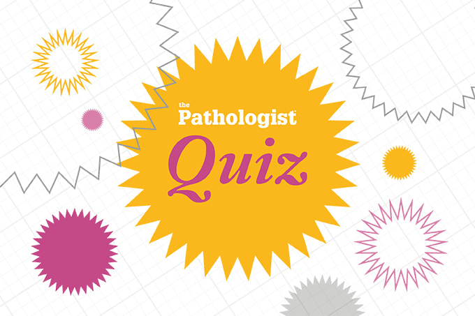 Quiz Time