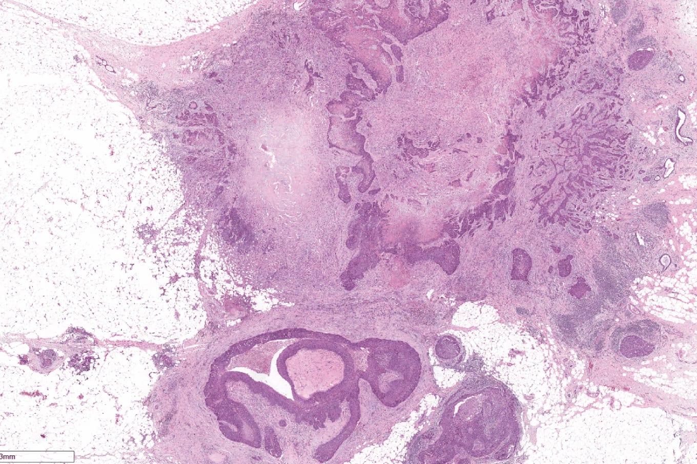 Case of the Month (2)