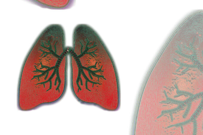 Diagnosis: Asthma