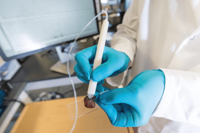 Putting Pen to Tumor