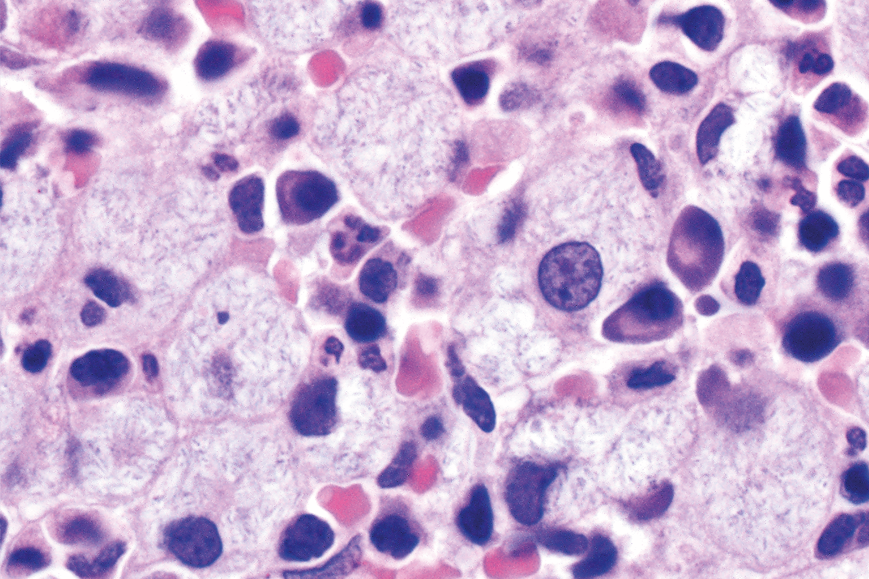 Case of the Month (2)