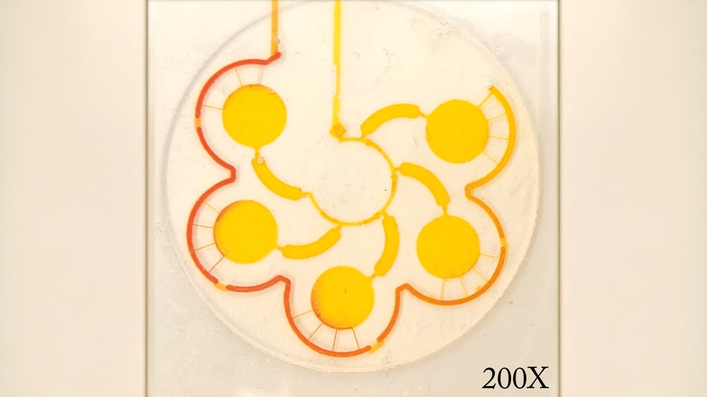 Wearable Microfluidic Biosensor Monitors Stress Hormones in Sweat
