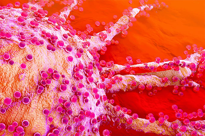 Personalized medicine – in vitro drug testing on primary cancer cells