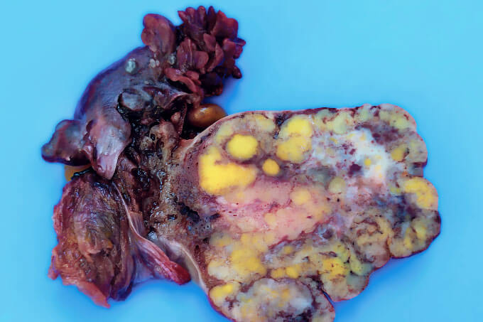 Case of the Month (9)