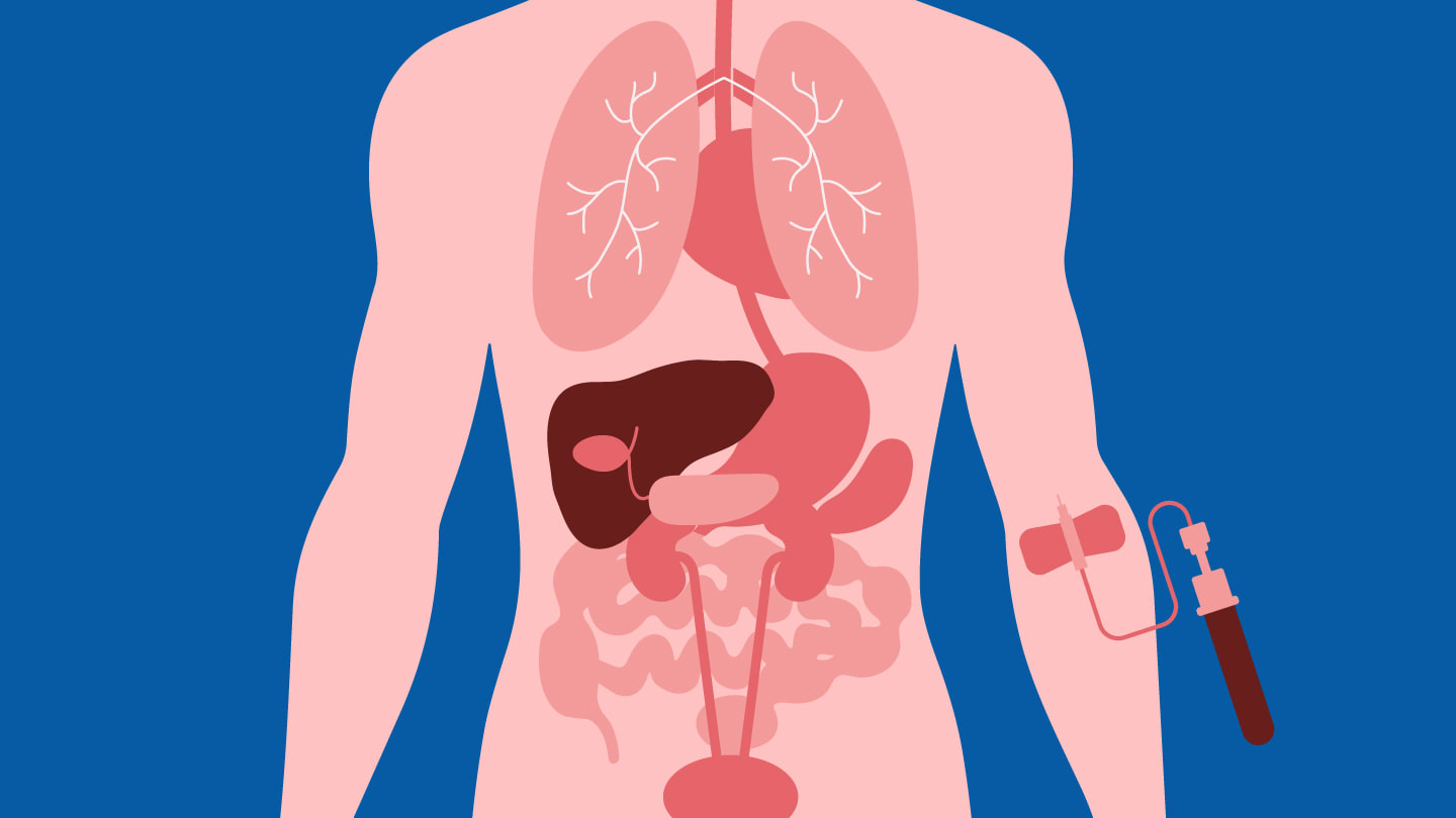 Earlier Detection of Organ Rejection