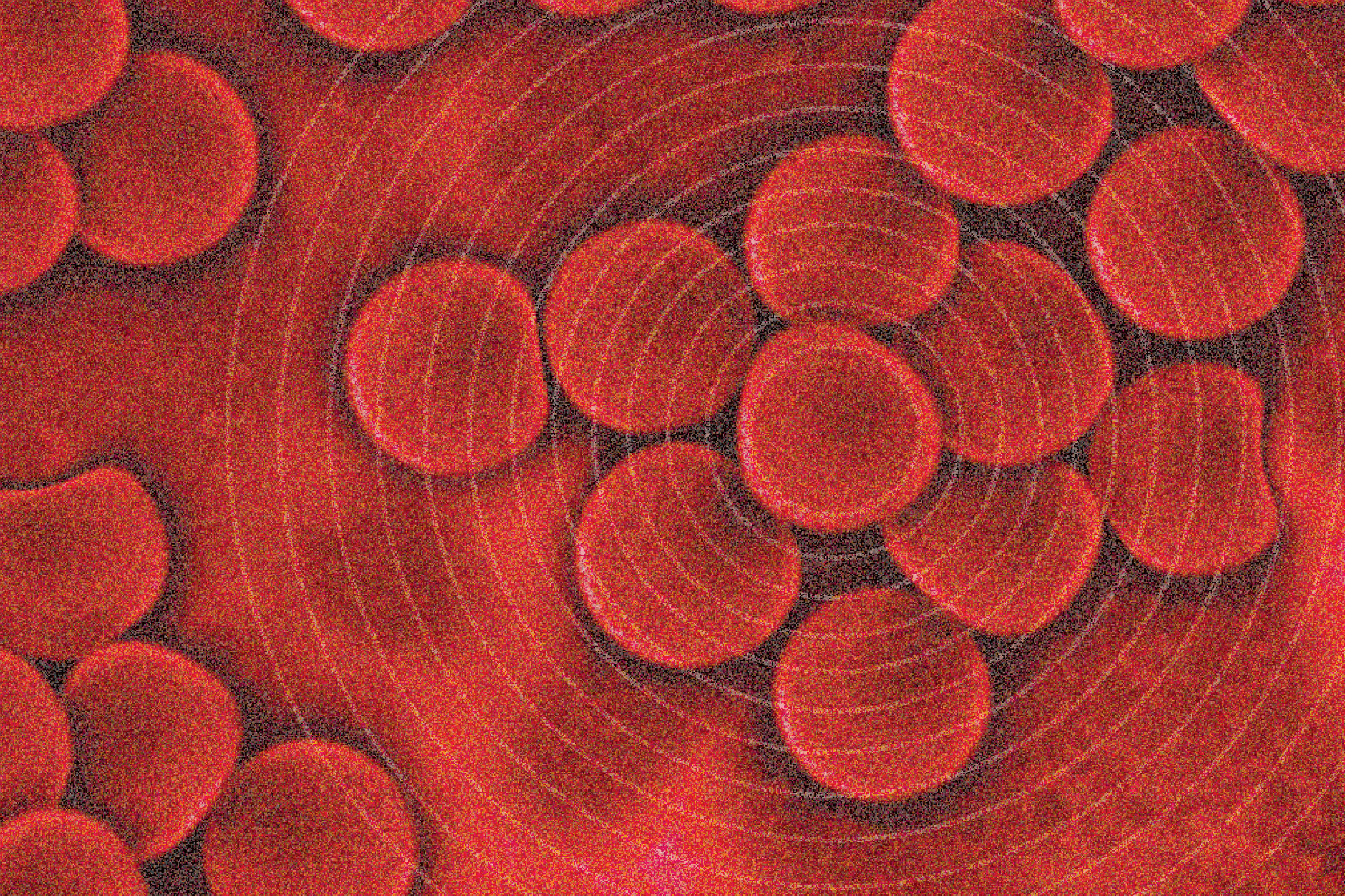Fluid Diagnosis – with SERS