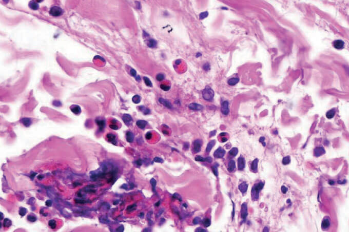 Case of the Month (7)