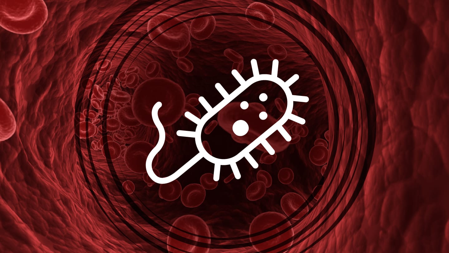 The 5Hour Sepsis Test No Cultures Required