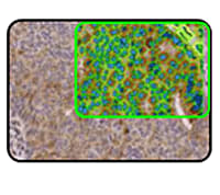 Aperio Image Analysis Workstation – Powerful Digital Pathology Image Analysis on Your PC