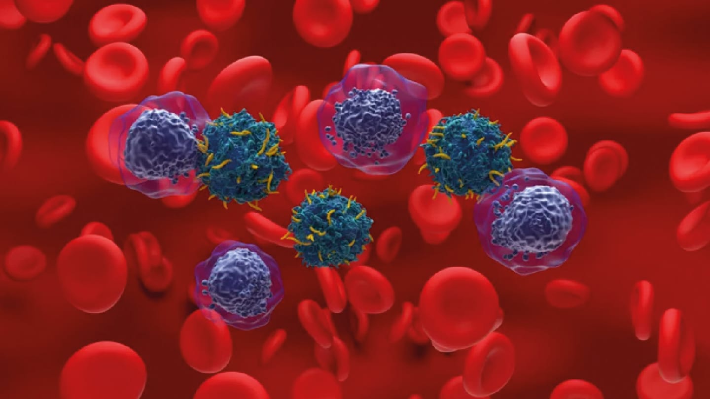 RNA Testing Uncovers Hidden Gene Fusions in AML