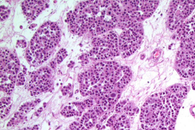 Case of the Month (1)