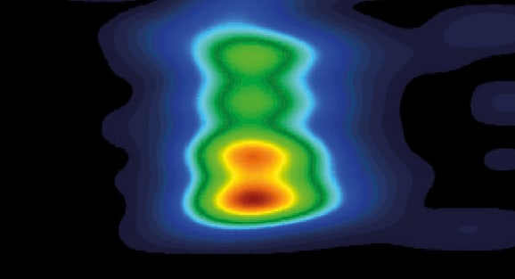 2D Analysis of Thermoplastic Elastomers TPE