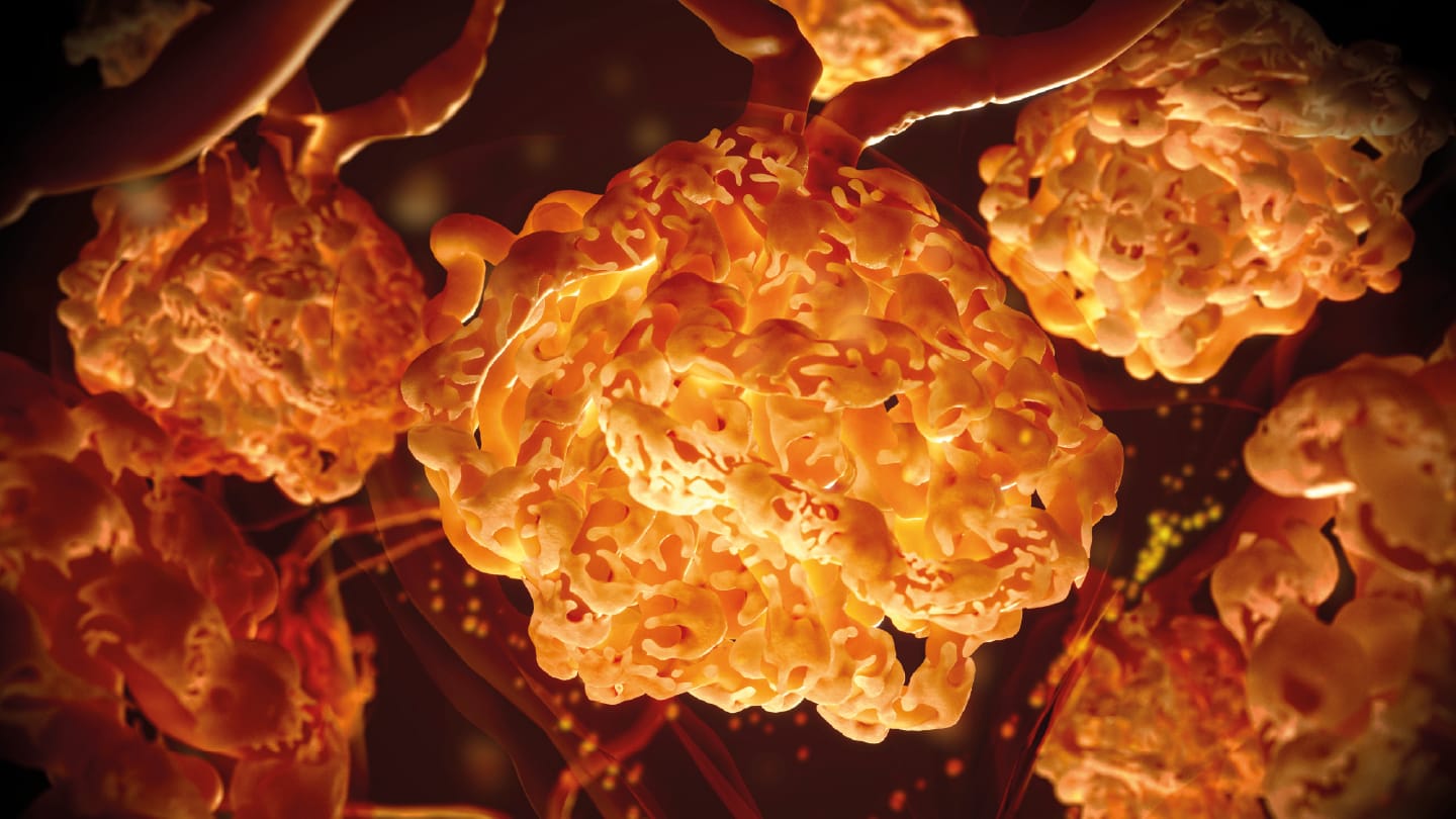 New AI Model Enhances Kidney Biopsy Segmentation