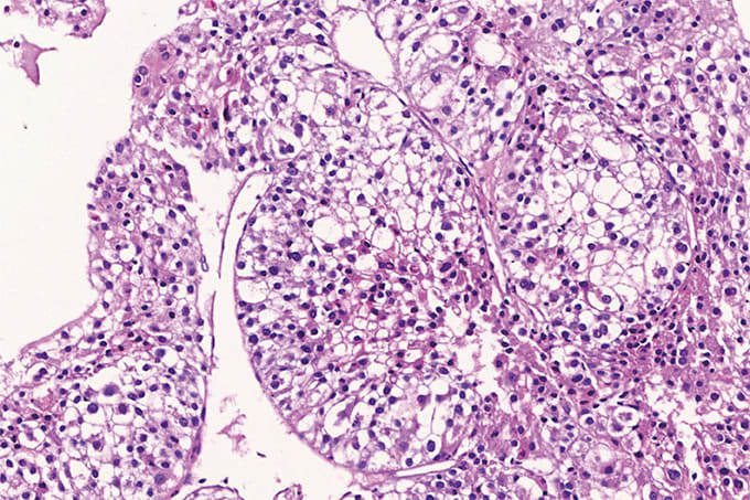 Case of the Month 0924