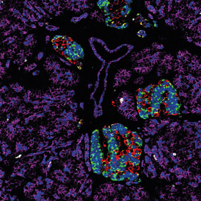 Our Research in Images: All Eyes on Precision Medicine