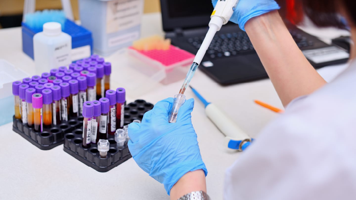 The Fluid Future of Liquid Biopsy