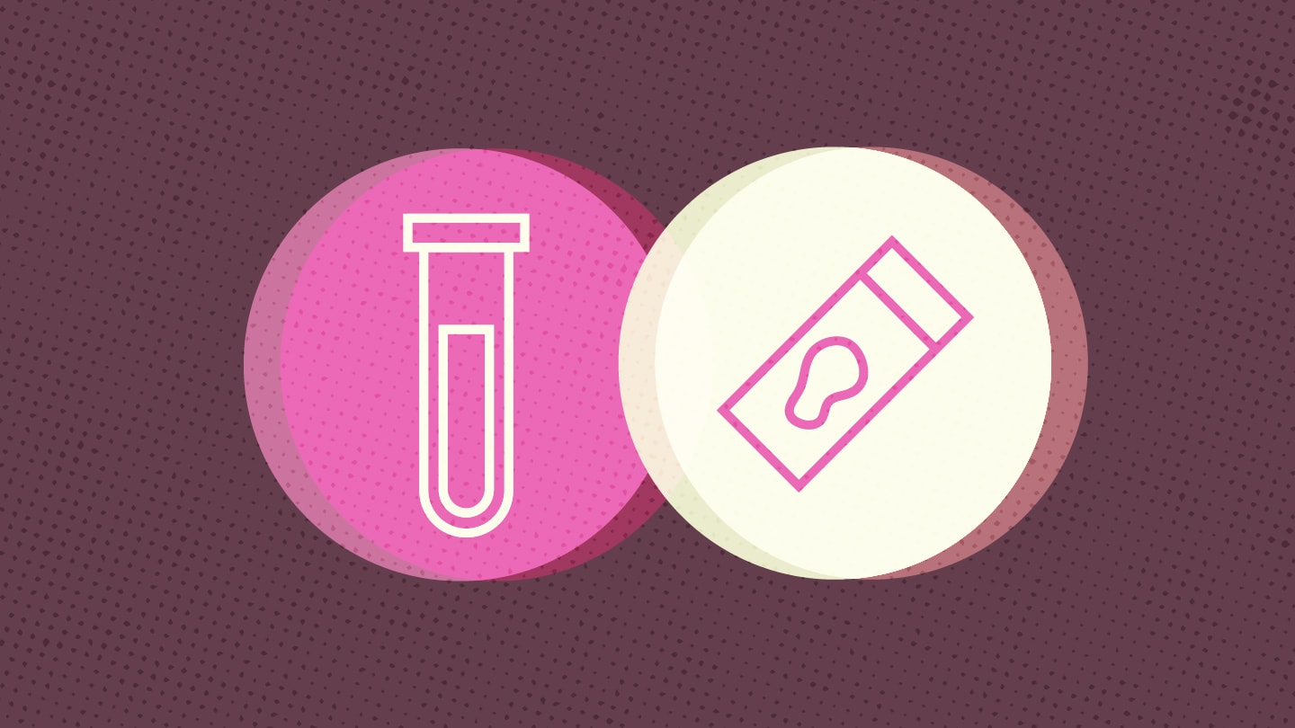 Tissue Versus Liquid Biopsy in Metastatic Breast Cancer