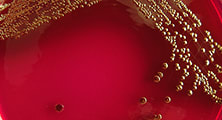 Bug ID by Mass Spec