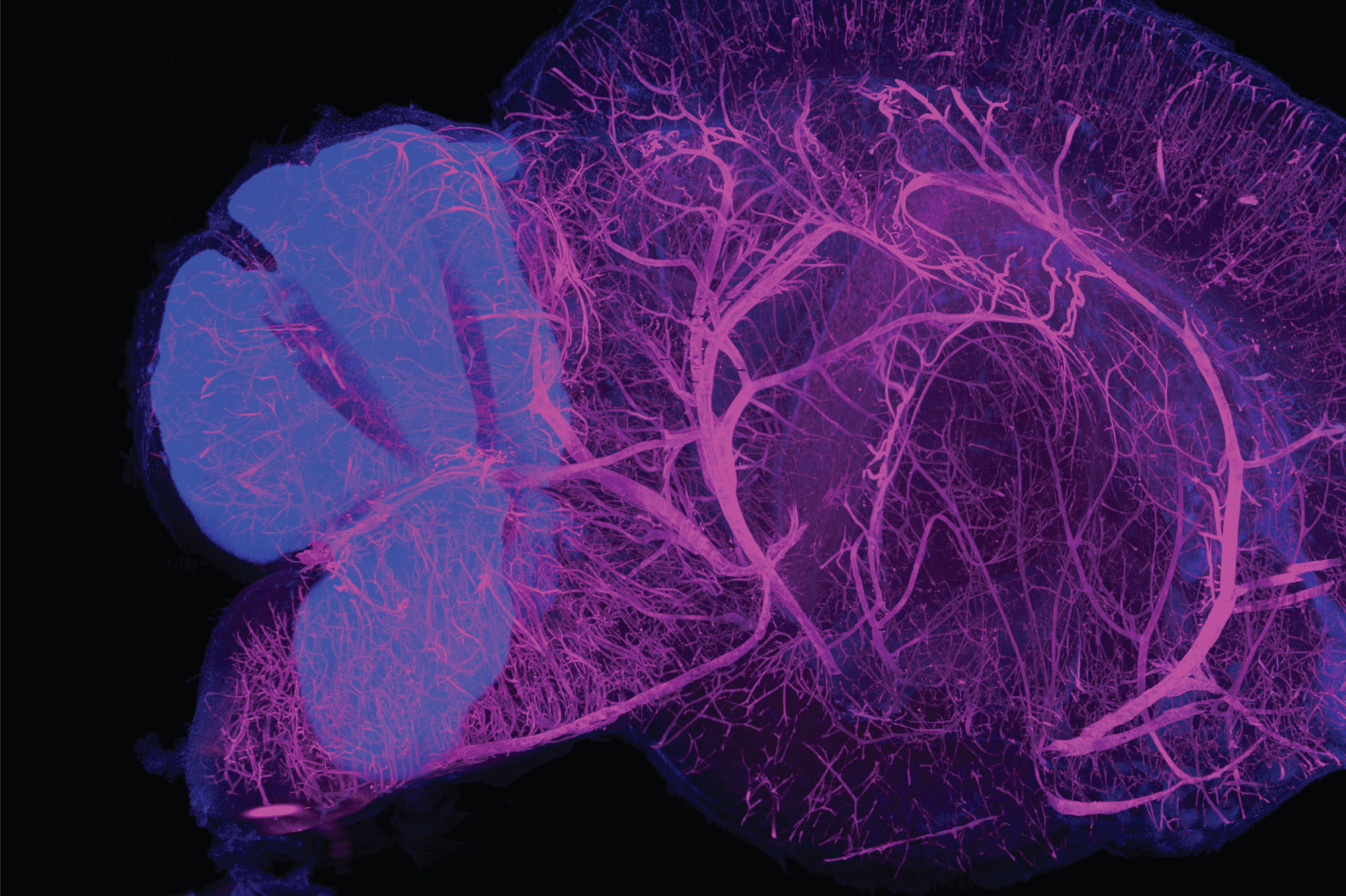3D Tissue Staining Visualizes Whole Organs