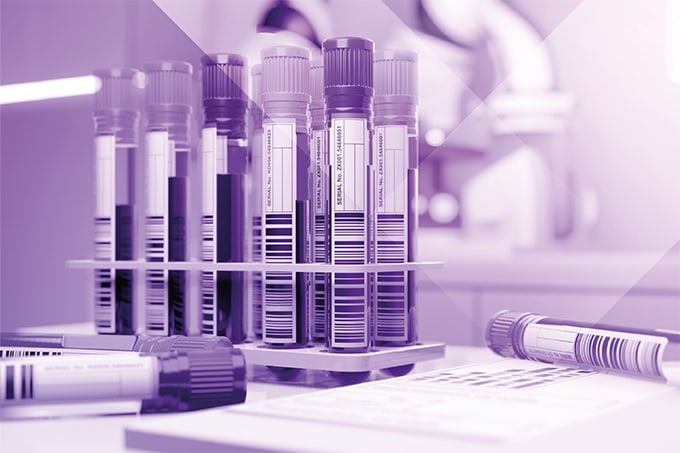 Simple Blood Test Rivals Mass Spec for Alzheimer’s Diagnosis