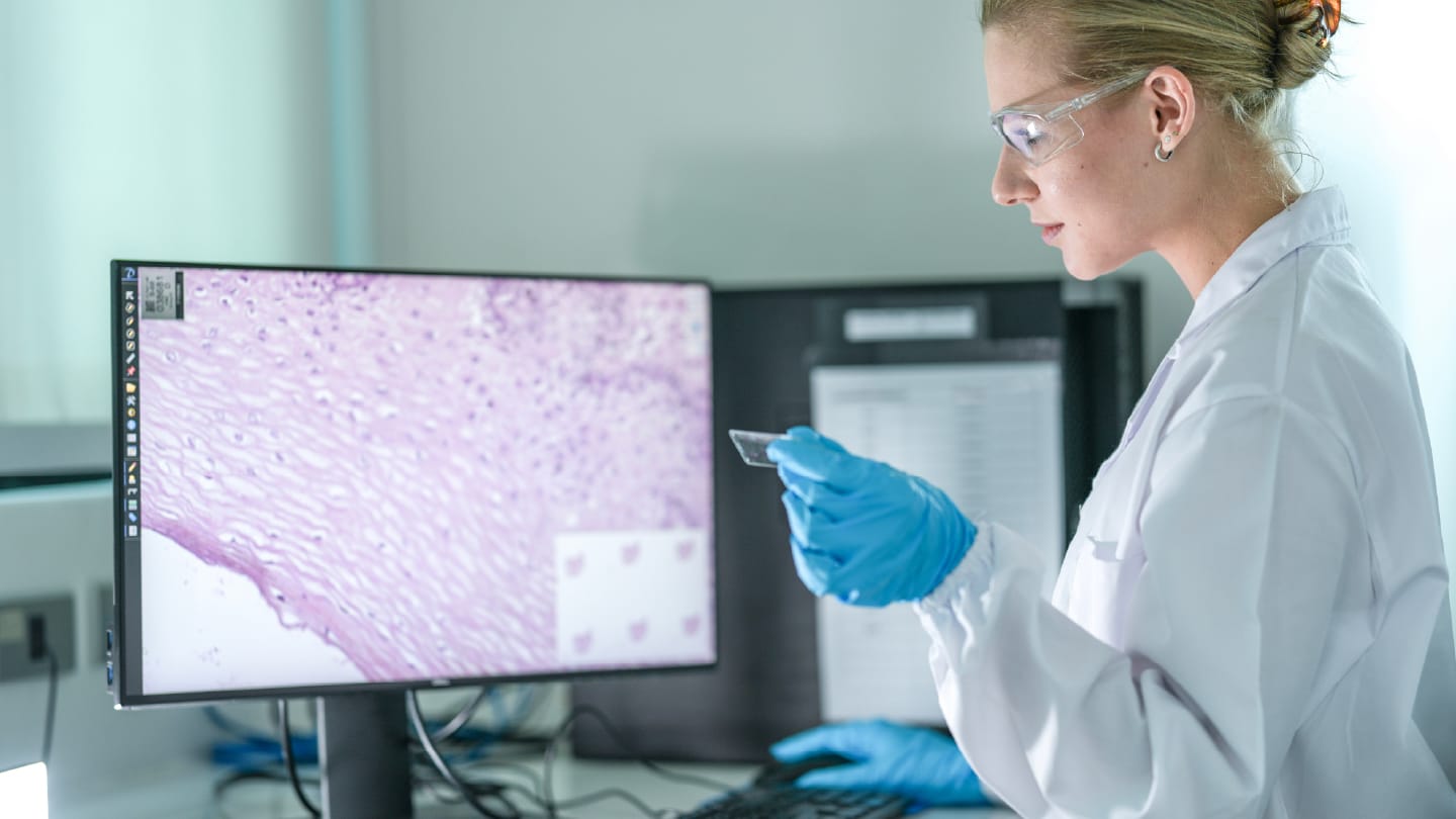 Slide Analysis Rebuilt for Data Age