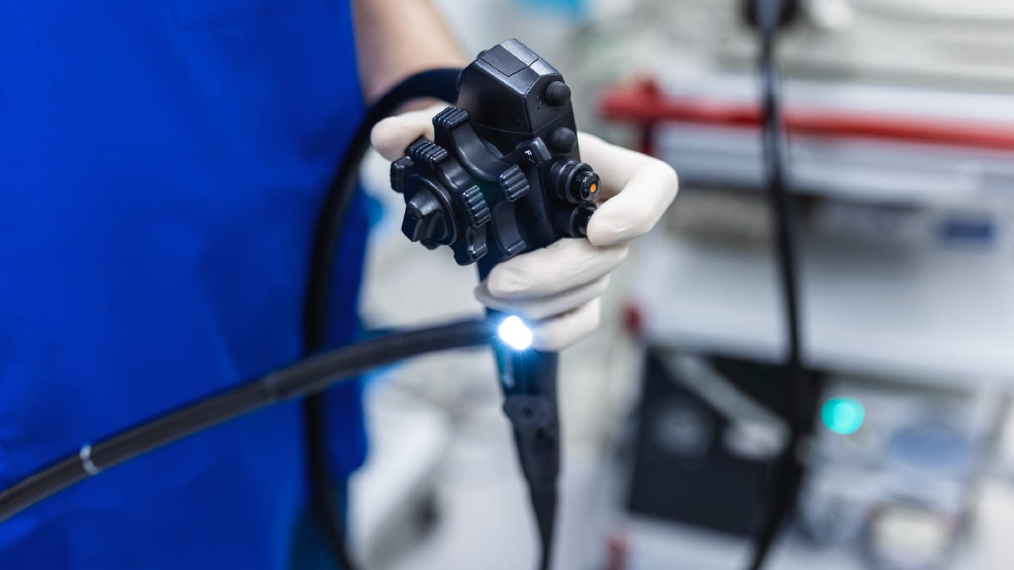 Can AI and Molecular Testing Outperform Colonoscopy