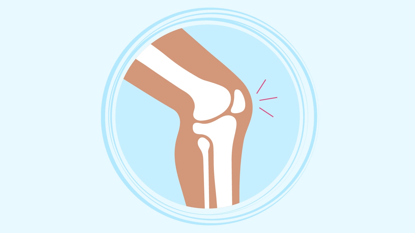 Spatial Proteomics Reveals Early Osteoarthritis Changes