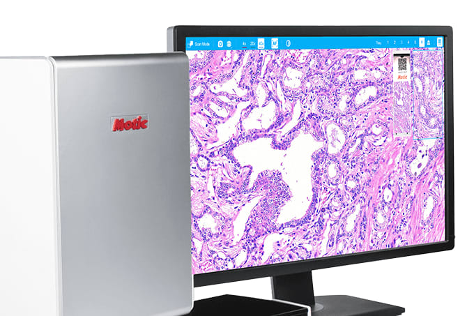 Live Remote Frozen Sections with Motic Digital Pathology's Affordable Six Slide Scanner