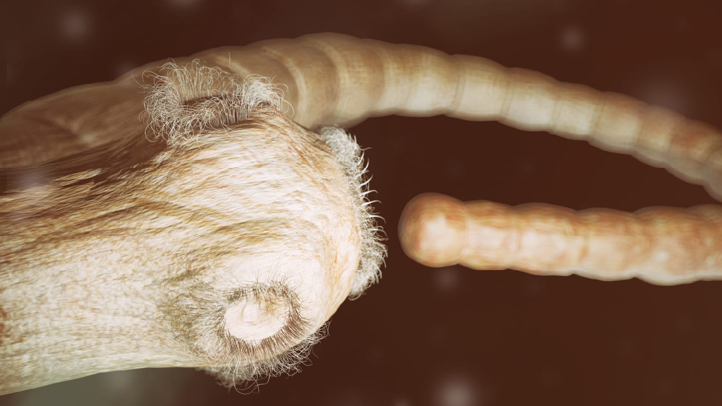 Hidden Parasite Spreads to Washington