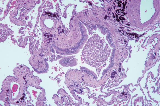 Case of the Month (3)